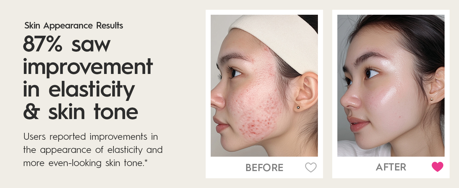 87% saw improvement in elasticity & skin tone